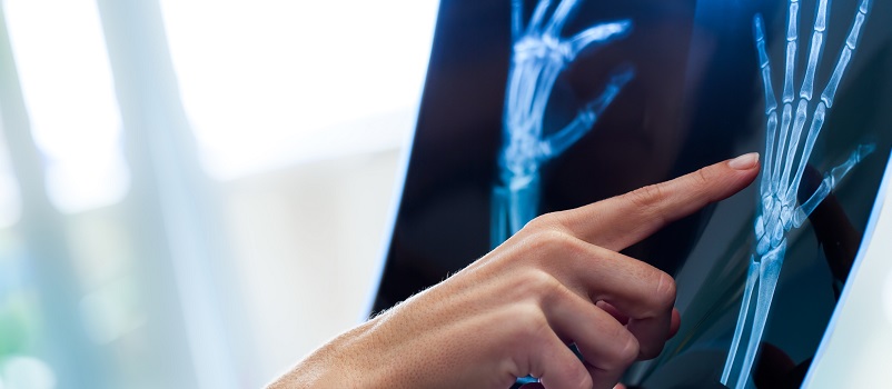 Ask the Upper Extremity Experts