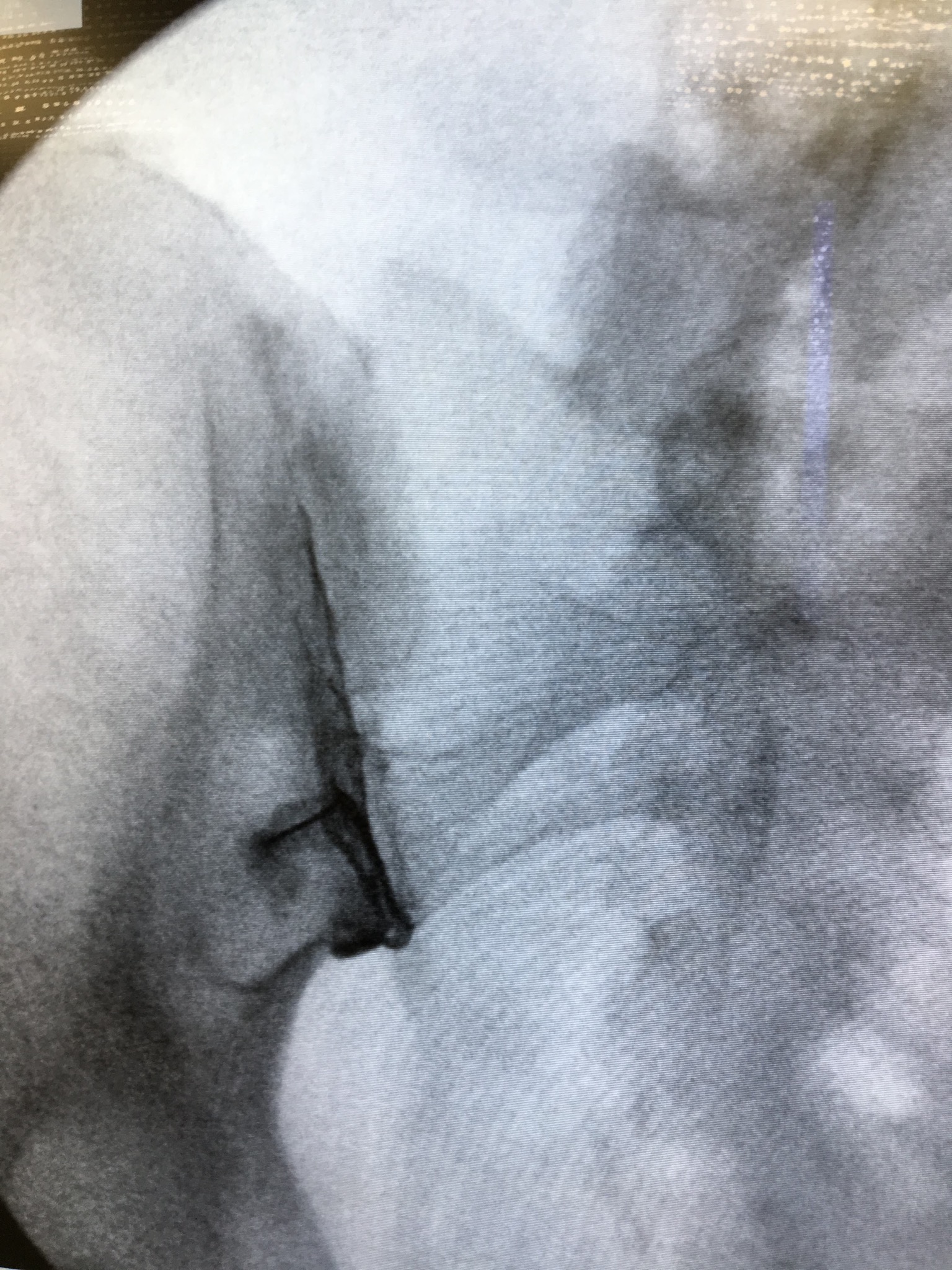 Interventional Pain Medicine