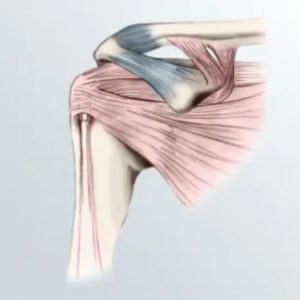 Group logo of Shoulder arthroplasty